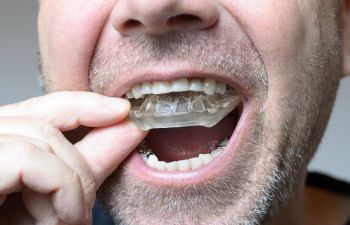 Mouthguard, Indian Land, SC